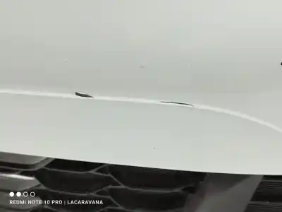 Second-hand car spare part front bumper for kia ceed concept 100 cv / 74 kw oem iam references 86511j7000  