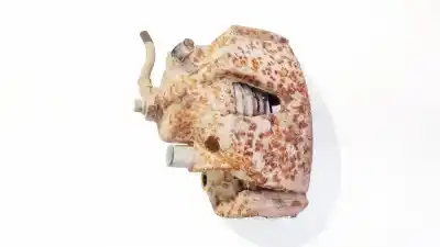 Peça sobressalente para automóvel em segunda mão pinça de travão dianteira esquerda por opel zafira a 2.0 dti referências oem iam 5725