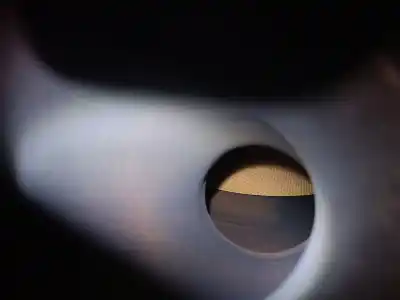 Автозапчасти б/у катализатор за peugeot 508 ii (fb_, fh_, f3_) 2.0 bluehdi 160 (fhehyr) ссылки oem iam psak742 1126015620000 